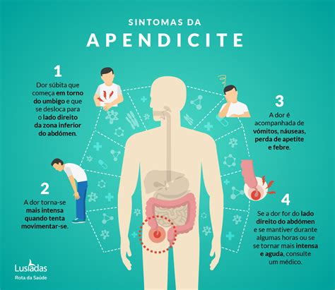 apendicite sintomas